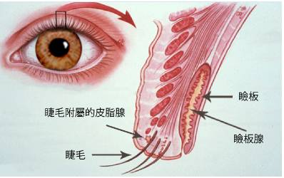 引起睑板腺障碍的原因